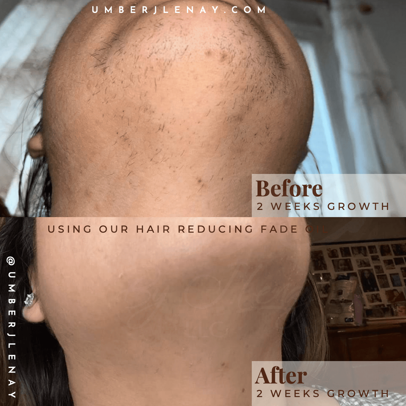 Chin and neck hair with 2 weeks of growth with and without hair reducing fade oil. Before and After