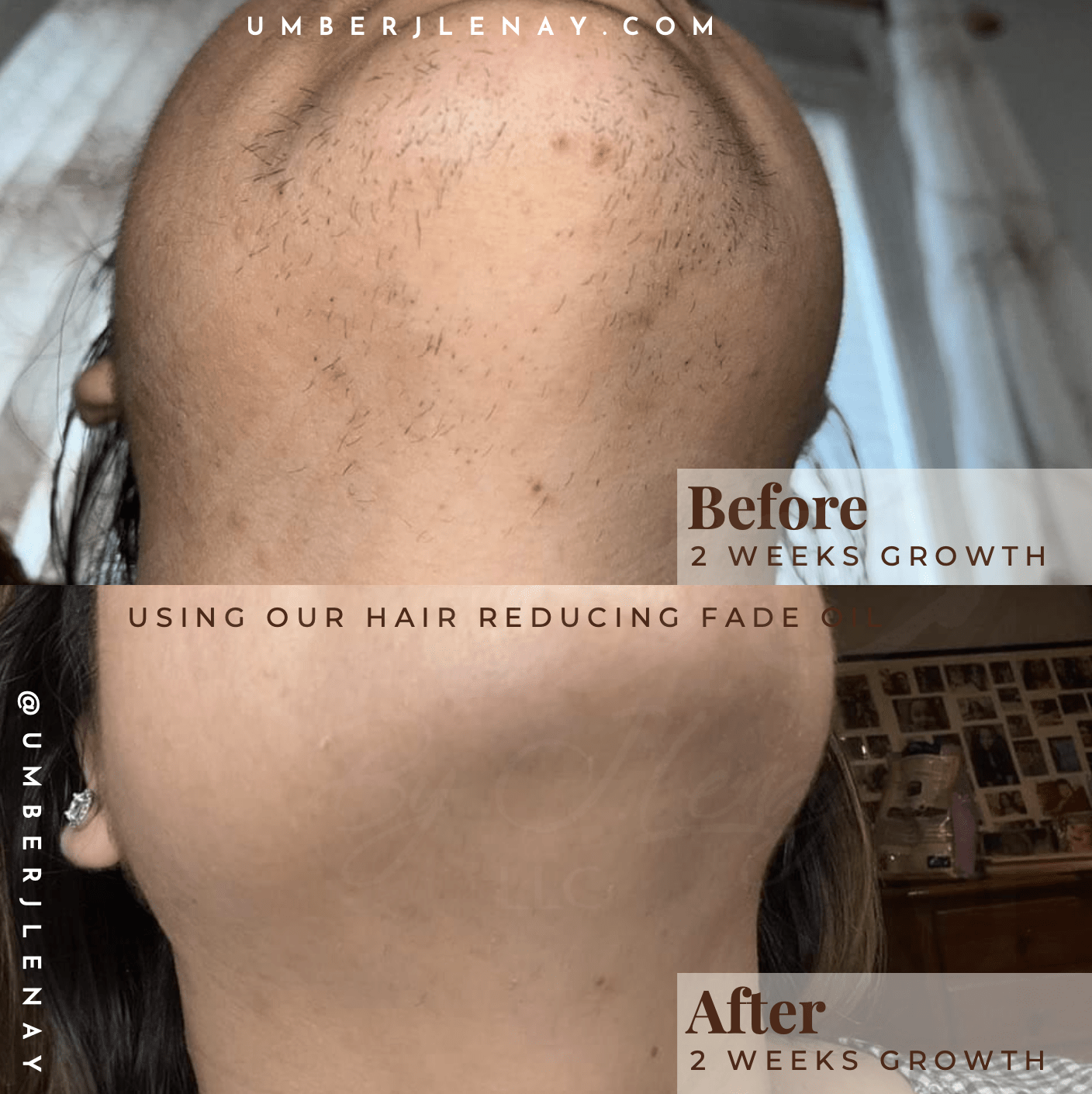 Chin and neck hair with 2 weeks of growth with and without hair reducing fade oil. Before and After