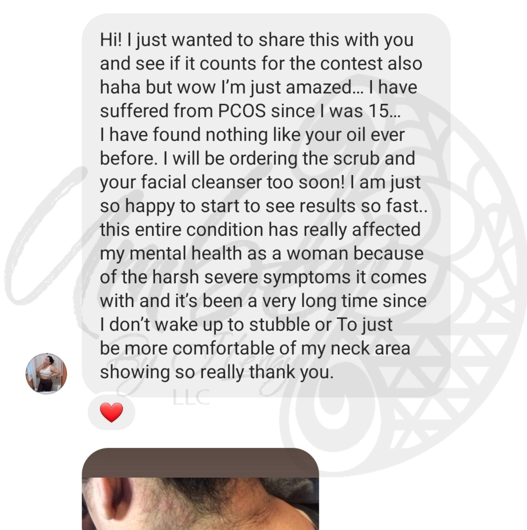 Client review of a person suffering with PCOS since they were 15 and saw fast results from the hormone balance face mask, scrub, cleanser